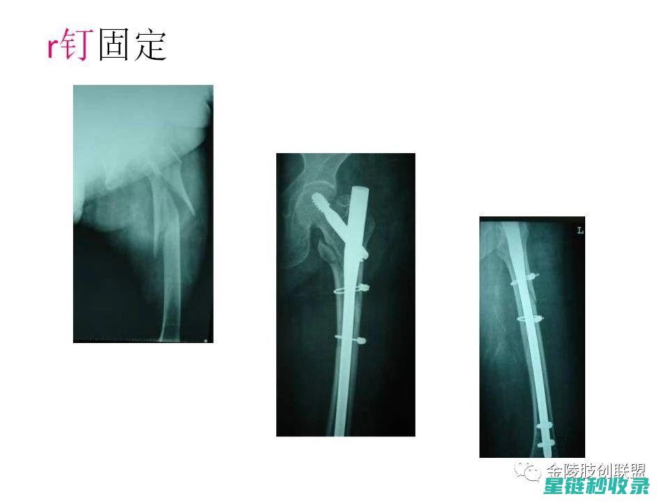 剖析钉子固定技术：从基础到高级应用 (剖析钉子固定的原理)