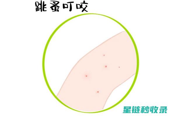 蚊虫叮咬后的止痒秘诀，你一定要知道 (蚊虫叮咬后的黑印子怎么去除)