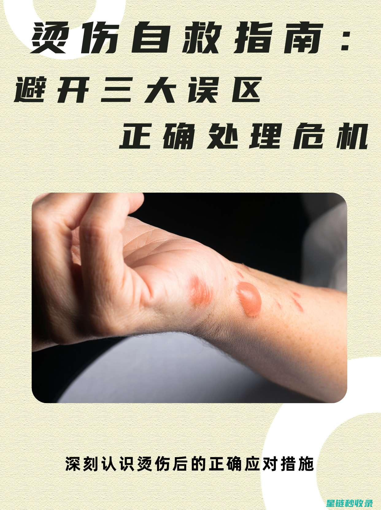 轻微烫伤后，这些急救方法能帮助你快速恢复 (轻微烫伤后擦什么药好得快)